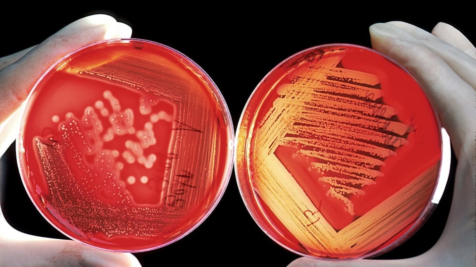 Hrozí nám návrat do éry před antibiotiky? (ilustrační foto)